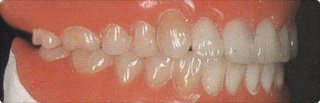 顎口腔欠損再構築学分野